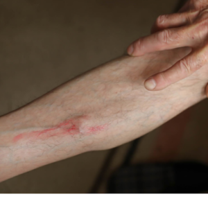 visible veins